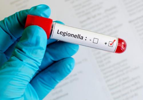 Legionellabesmetting bij Albertstroom NV